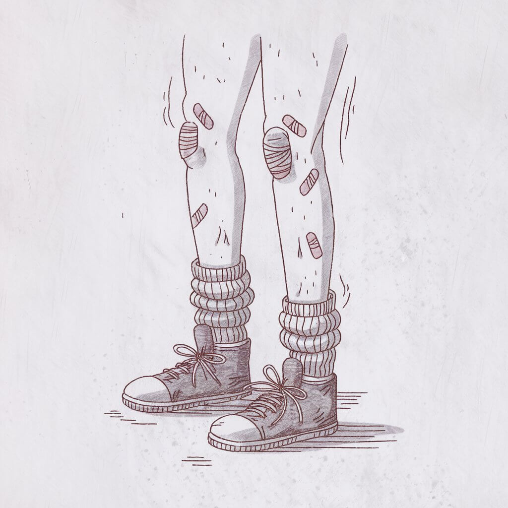 A minimalist, plain white background pencil drawing illustration of clumsy legs covered in small bandages and scratches. The legs are slightly awkward in stance, with knees bearing rough patches and band-aids. Rolled socks and scuffed shoes add a humorous touch, while light shading accentuates the playful imperfections. Drawn in a simplistic style, the image captures relatable charm with its clean, intentional lines.